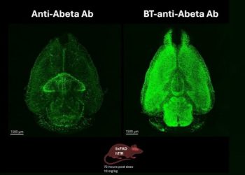 Biotech behind Alzheimer’s drug seeks partners for blood-brain barrier technology