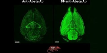 Biotech behind Alzheimer’s drug seeks partners for blood-brain barrier technology