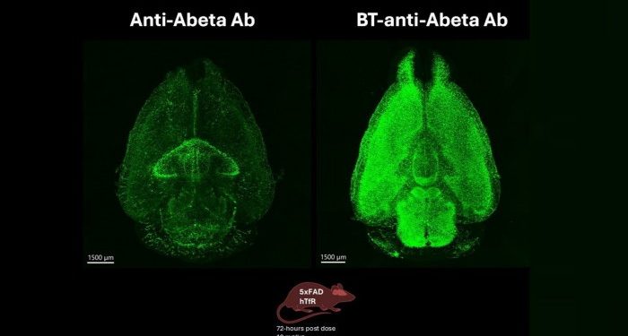 Biotech behind Alzheimer’s drug seeks partners for blood-brain barrier technology