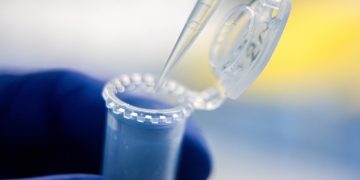 Scientists warn Trump’s $4bn funding cuts will harm US medical research