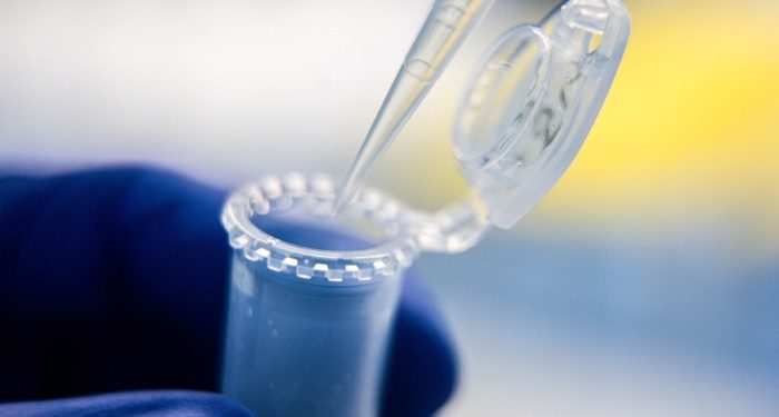 Scientists warn Trump’s $4bn funding cuts will harm US medical research