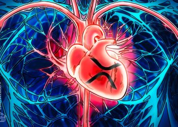 5 Key Factors Behind Its Growing Value