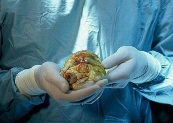 Why Climate Change Matters To Me (and You)