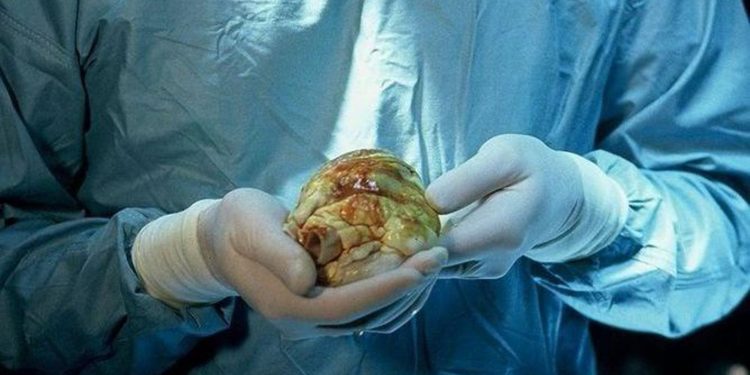 Why Climate Change Matters To Me (and You)